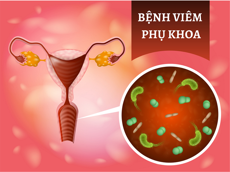 viem-nhiem-vung-kin1