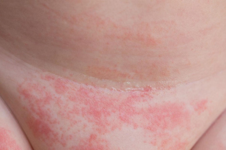 noi-man-do-o-vung-kin-nu-gioi-1