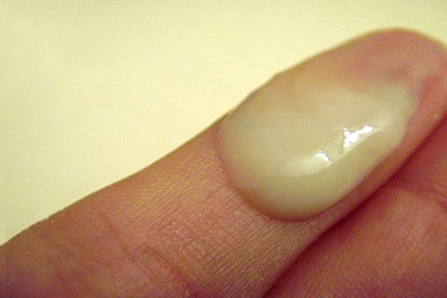 ra-huyet-trang-mau-xanh-2